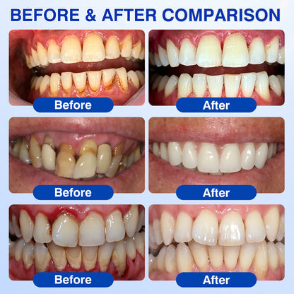 🔥Buy 2 Get 1 FREE & 🚚FREE Shipping - Advanced Enamel & Gum Care